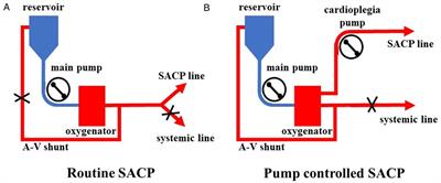 Efficacy of pump-controlled selective antegrade cerebral perfusion in total arch replacement: A propensity-matched analysis